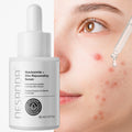 Niacinamide 10% + Zinc 1% Facial Serum – Balancing & Smoothing Daily Skincare, 30ml